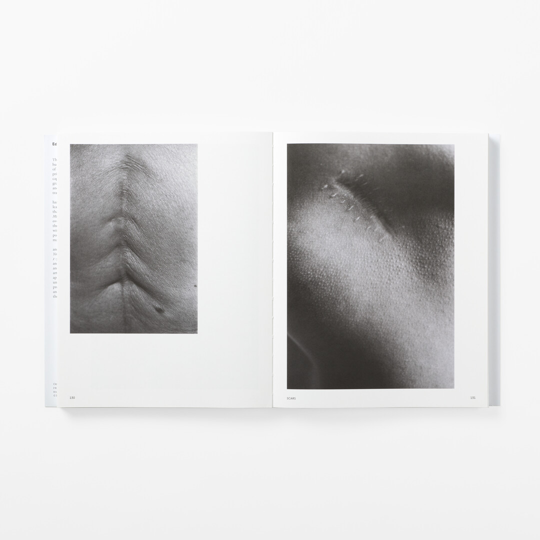 A spread of two photographs from Ishiuchi Miyako's Traces from Japan House London.